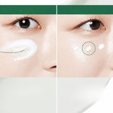 Anua Heartleaf Centella Red Spot Creme - 30 g