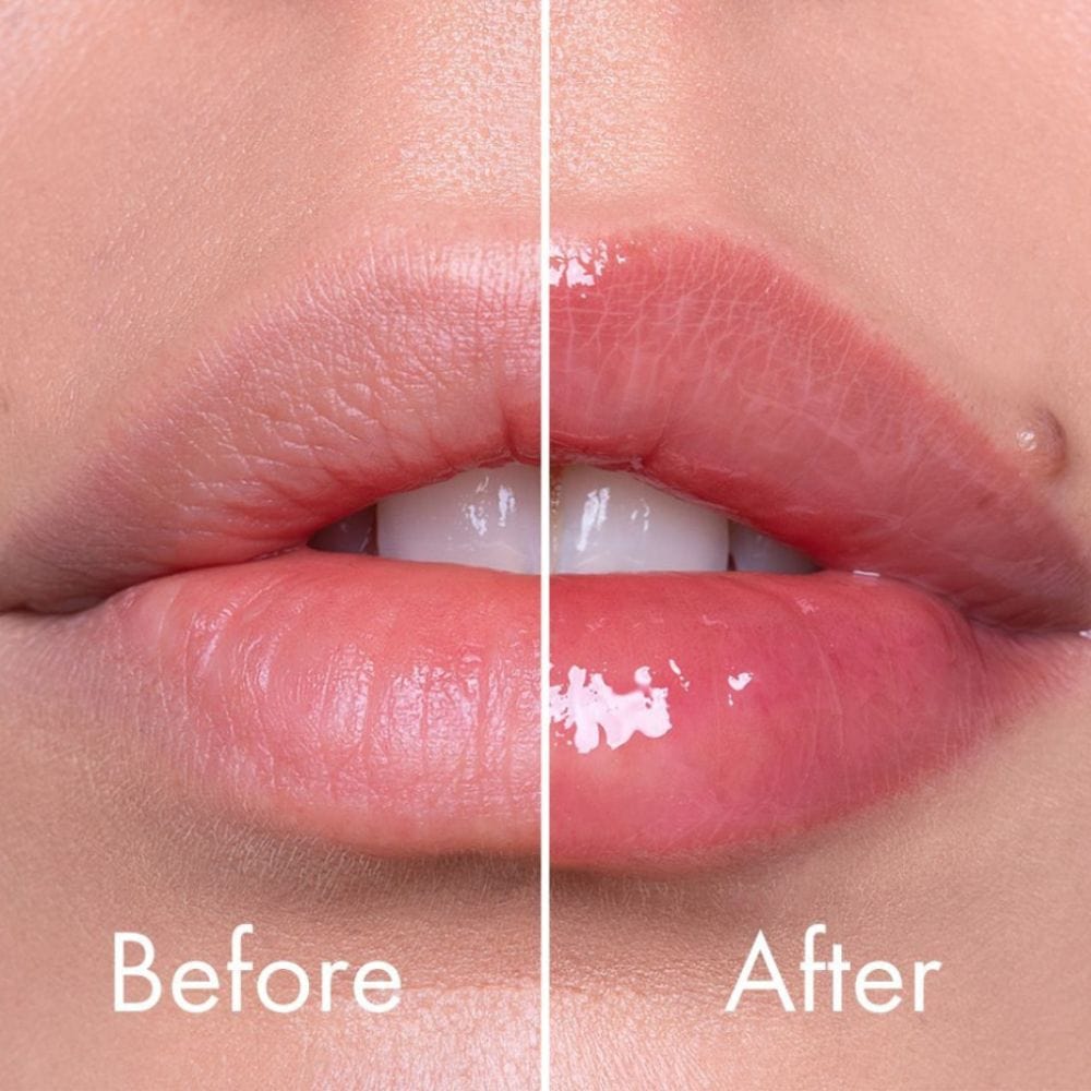 VT Cosmetics Reedle Shot Booster Lip Plumper - 4,3 g